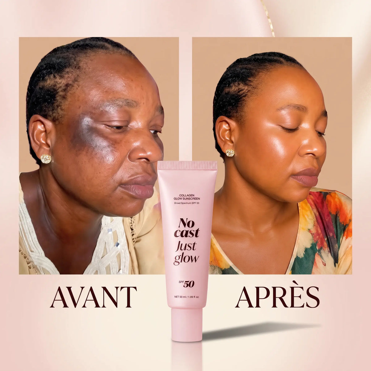 Crème Khairni Réparatrice — Le Secret des Peaux Abîmées qui Retrouvent leur Éclat Naturel